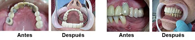 antes-despues